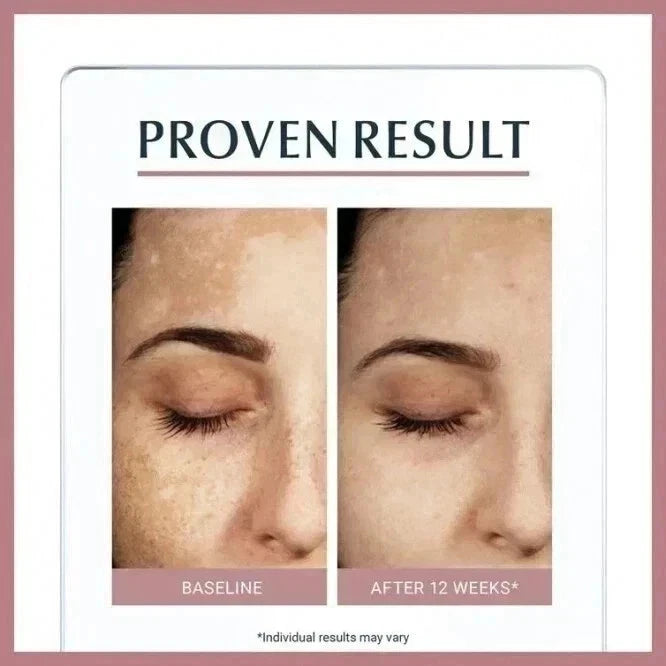 Eucerin Anti-Pigment Dual Serum for Face – Dark Spots & Pigmentation, 30ml